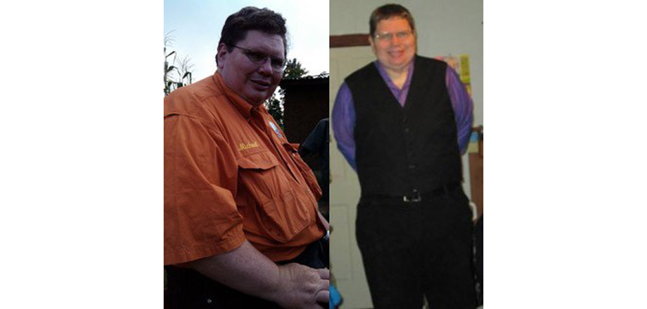 Michael Dickerson Before and After Photo